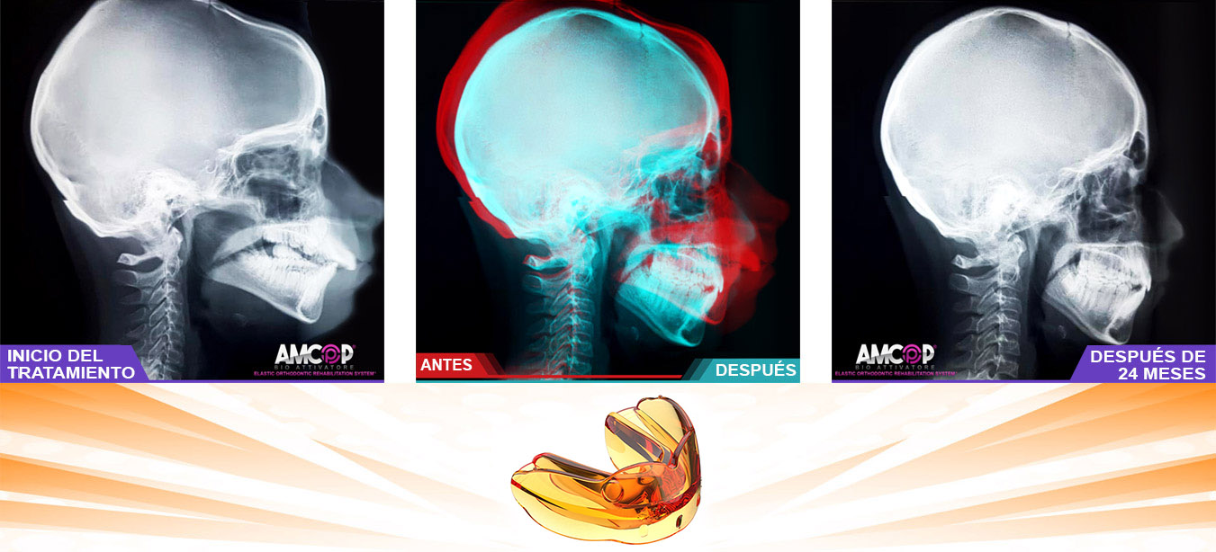 ORTHOPEDICS OF THE MAXILLARS MANDIBULAR SKULL